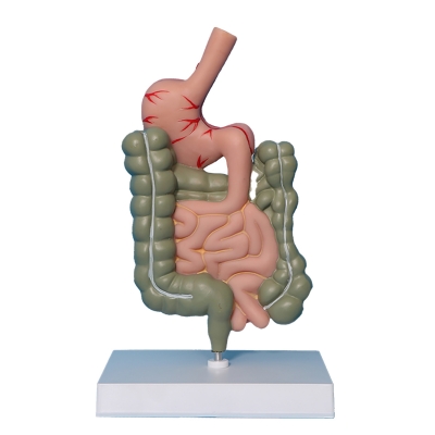 Патологическая модель толстой кишки желудочно-кишечного тракта Corpo GIT-2